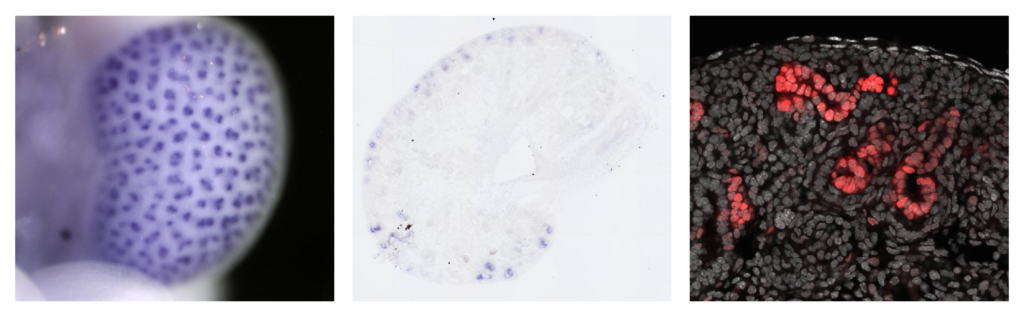 Expression du gène Sox9 dans le rein embryonnaire de souris